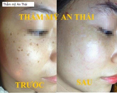 Cảnh quan Thẩm mỹ An Thái