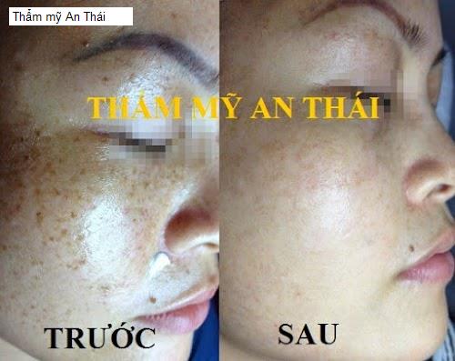 Vị trí Thẩm mỹ An Thái