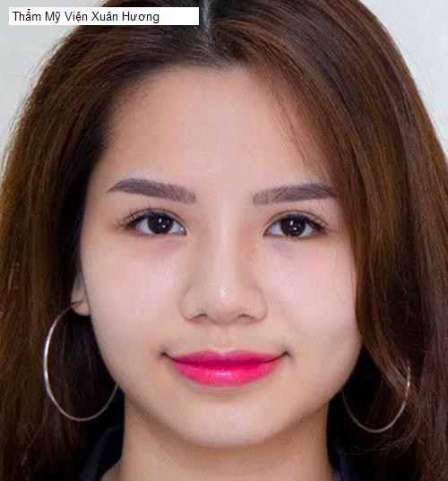 Chất lượng Thẩm Mỹ Viện Xuân Hương