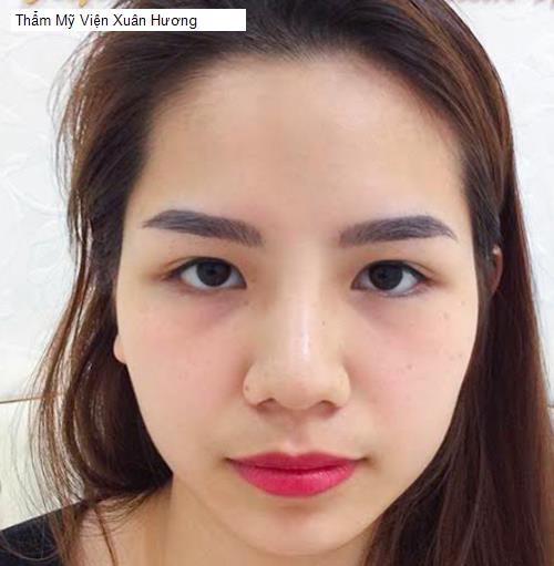 Bảng giá Thẩm Mỹ Viện Xuân Hương