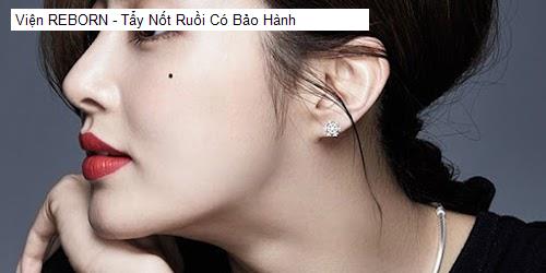 Viện REBORN - Tẩy Nốt Ruồi Có Bảo Hành