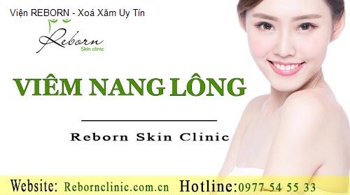 Viện REBORN - Xoá Xăm Uy Tín