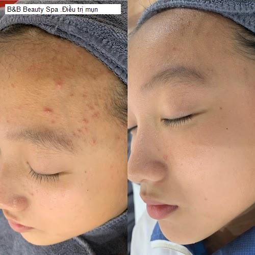 Nội thât B&B Beauty Spa .Điều trị mụn