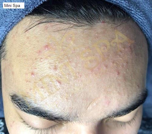 Hình ảnh Mini Spa