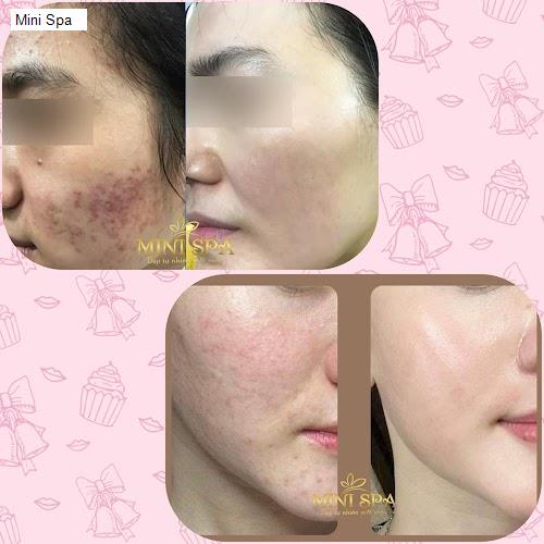 Chất lượng Mini Spa
