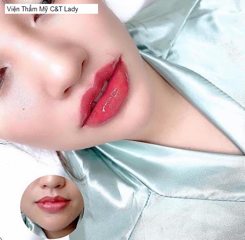 Bảng giá Viện Thẩm Mỹ C&T Lady