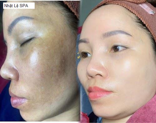 Nhật Lệ SPA