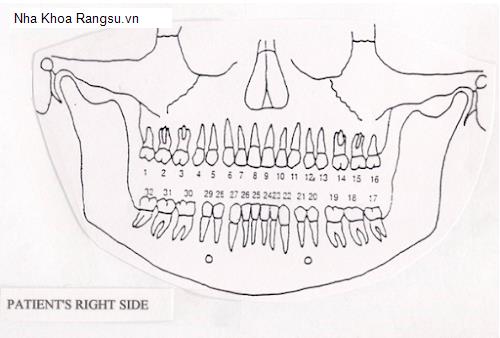 Hình ảnh Nha Khoa Rangsu.vn